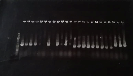T--Aix-Marseille--TolA3 P3-N1 PCR colony picture.png